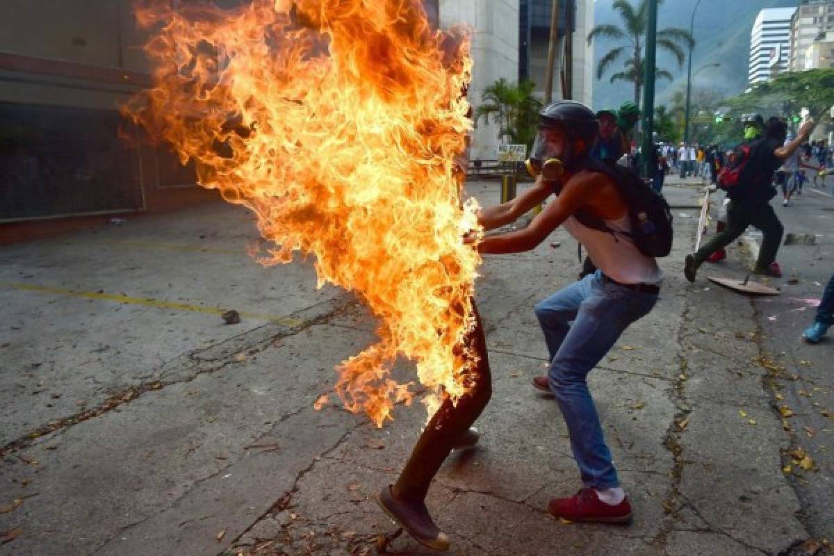 Murió hombre que había sido quemado en protesta opositora en Venezuela