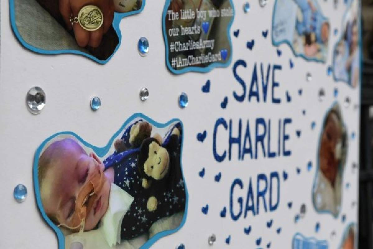 Falleció Charlie Gard, el bebé británico enfermo terminal (familia)