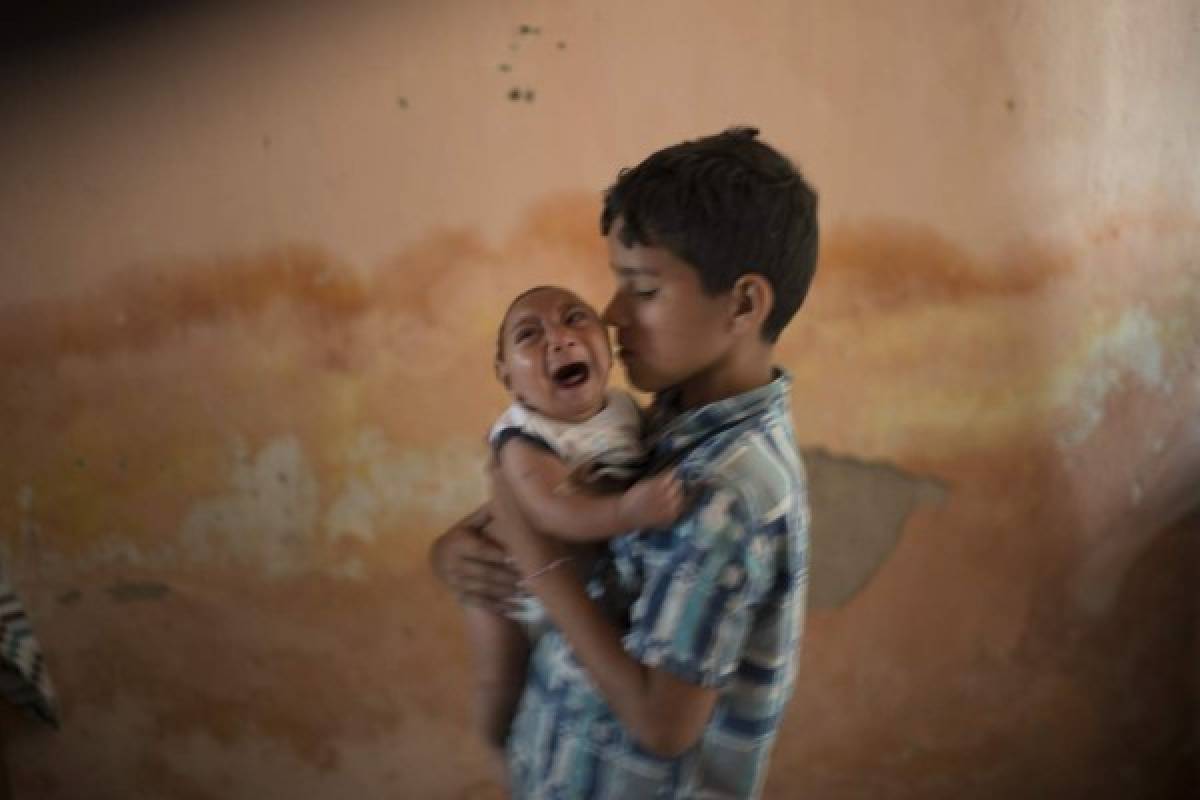 Suben casos de microcefalia que Brasil liga a brote de zika  