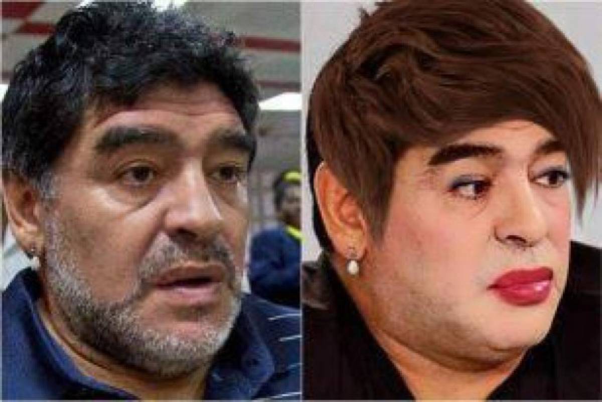 Maradona se opera los labios y revoluciona las redes