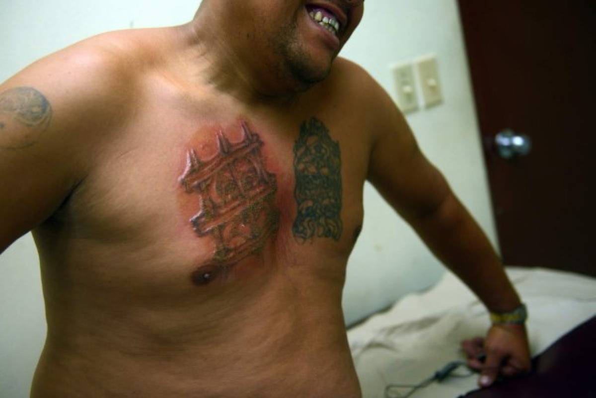Expandilleros salvadoreños buscan eliminar tatuajes para borrar estigmas