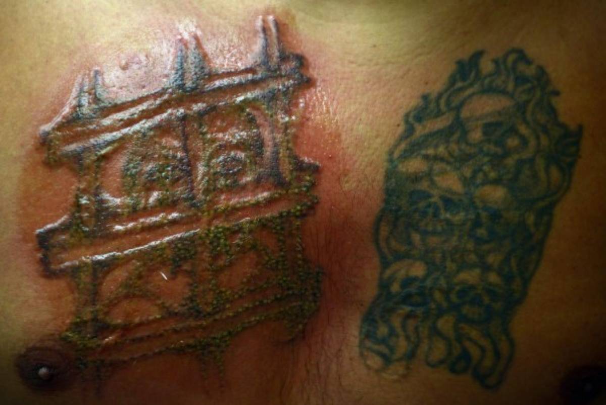 Expandilleros salvadoreños buscan eliminar tatuajes para borrar estigmas