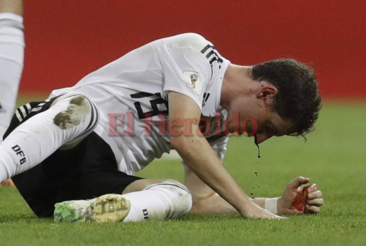 Alemania vs Suecia: Así fue la patada que Ola Toivonen le dio en la cara a Sebastián Rudy