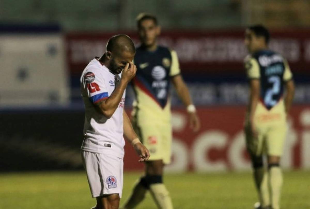 No le perdonan a Ezequiel Aguirre la que falló ante el América