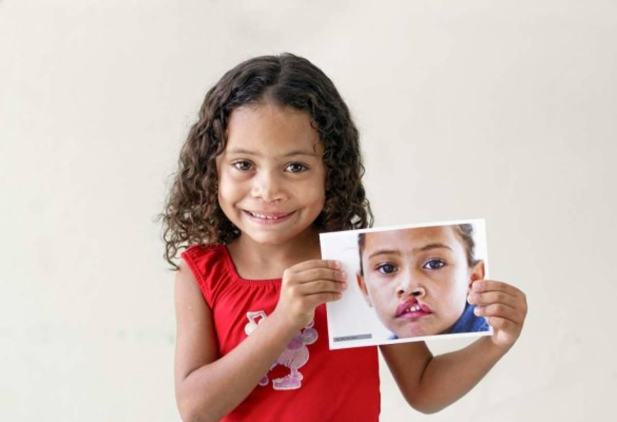 Ellos son pequeños que forman parte de 'Operación Sonrisa'.