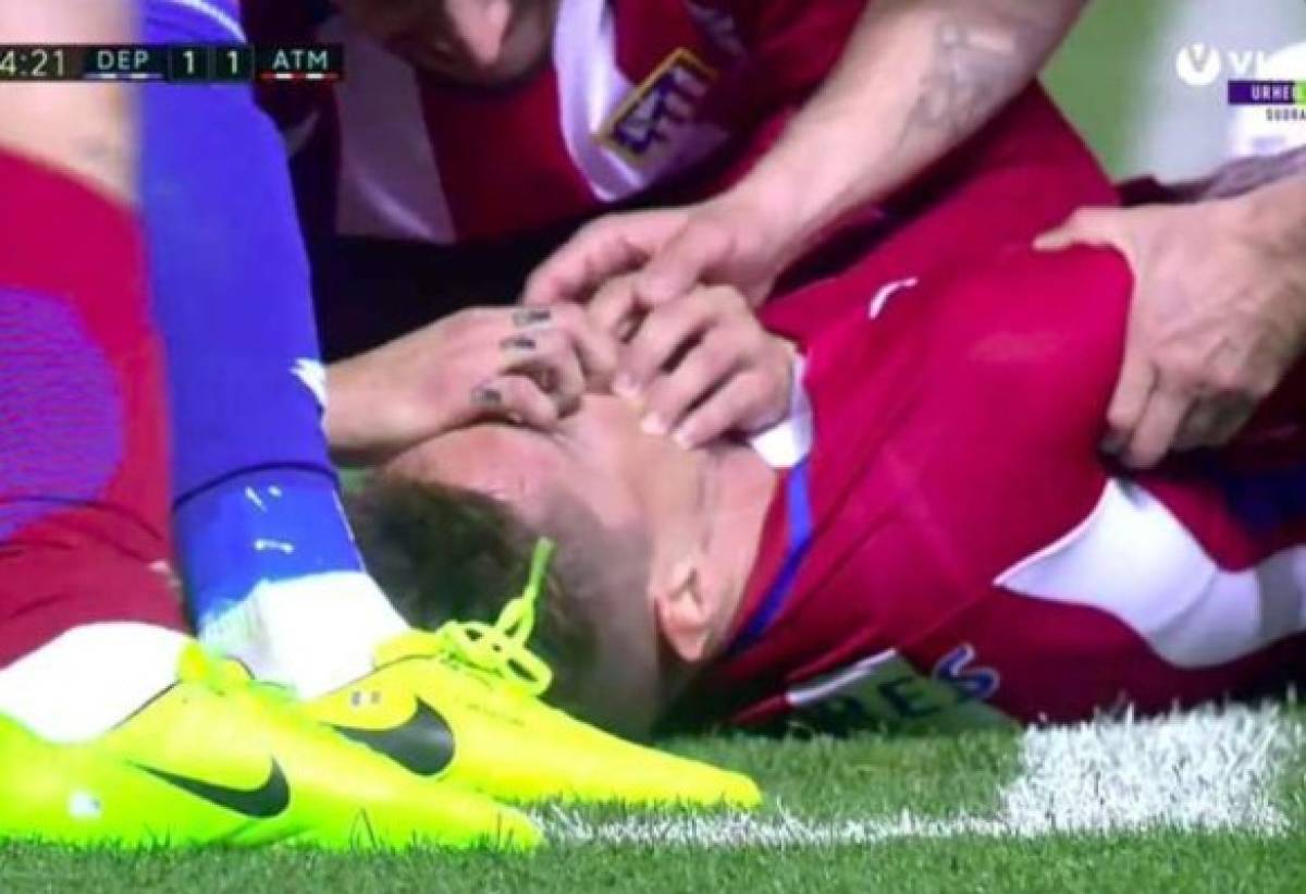 Video muestra la aparatosa caída de Fernando Torres, delantero del Atlético de Madrid