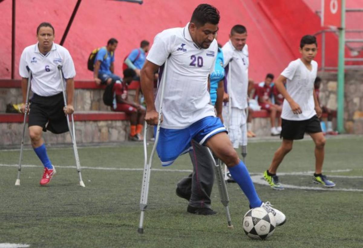 Selección de Amputados de Honduras, aquí no hay límites, solo sueños y esperanzas