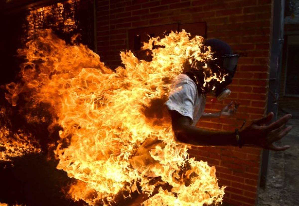 Un manifestante se prendió fuego accidentalmente durante fuertes disturbios en una protesta contra el presidente de Venezuela, Nicolás Maduro, en el este de Caracas, foto: Agencia AFP.