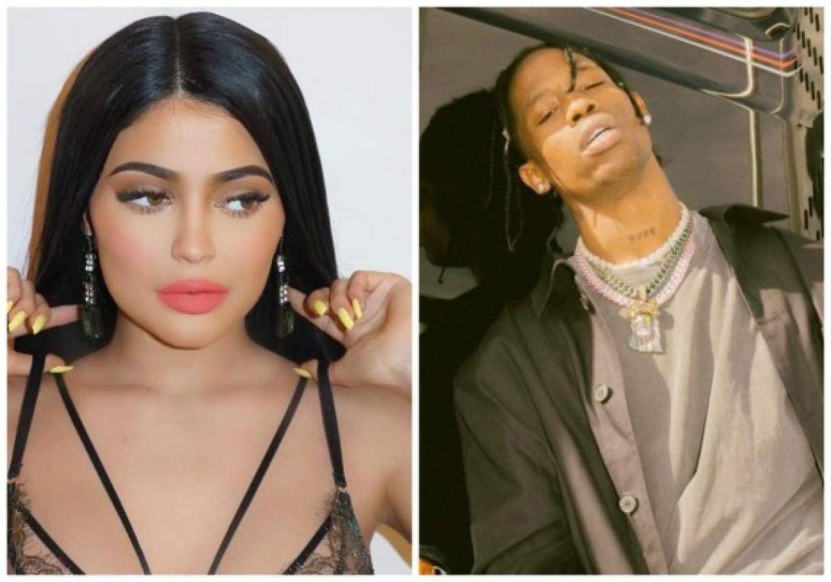 Kylie Jenner no podrá rellenarse los labios durante su embarazo