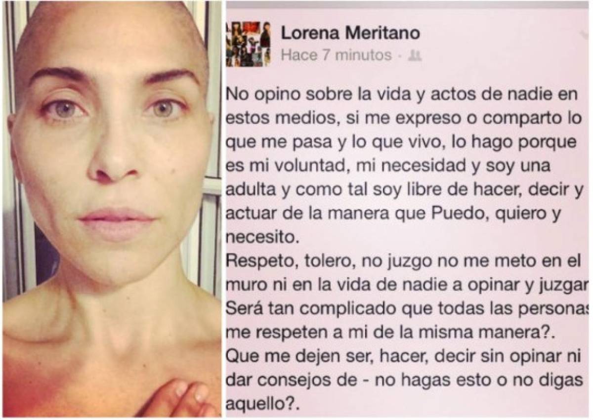 Actriz Lorena Meritano muestra cómo quedó su cuerpo tras sufrir cáncer de mama
