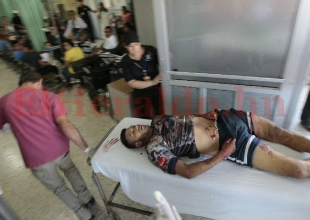 Dos muertos y dos heridos deja balacera en colonia Suyapa de Tegucigalpa