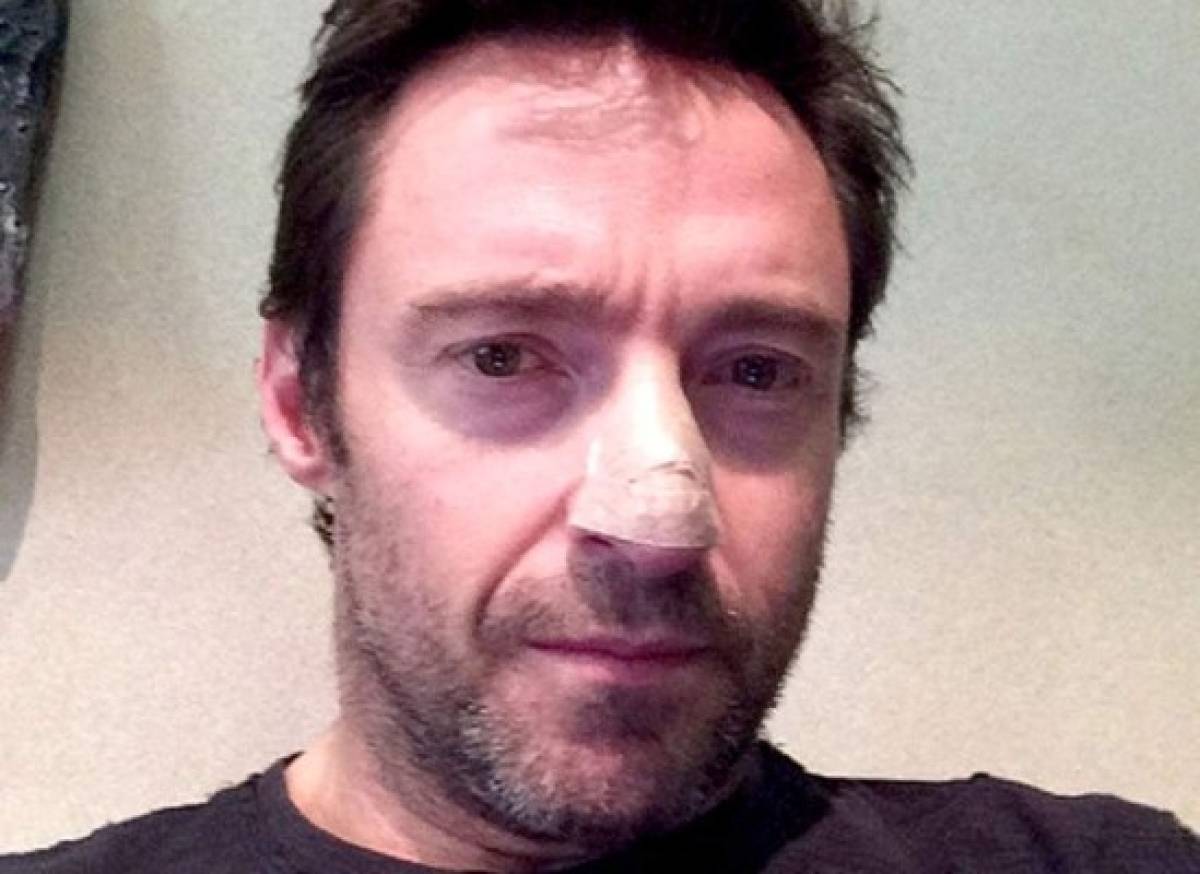 Hugh Jackman continúa ganándole la batalla al cáncer de piel