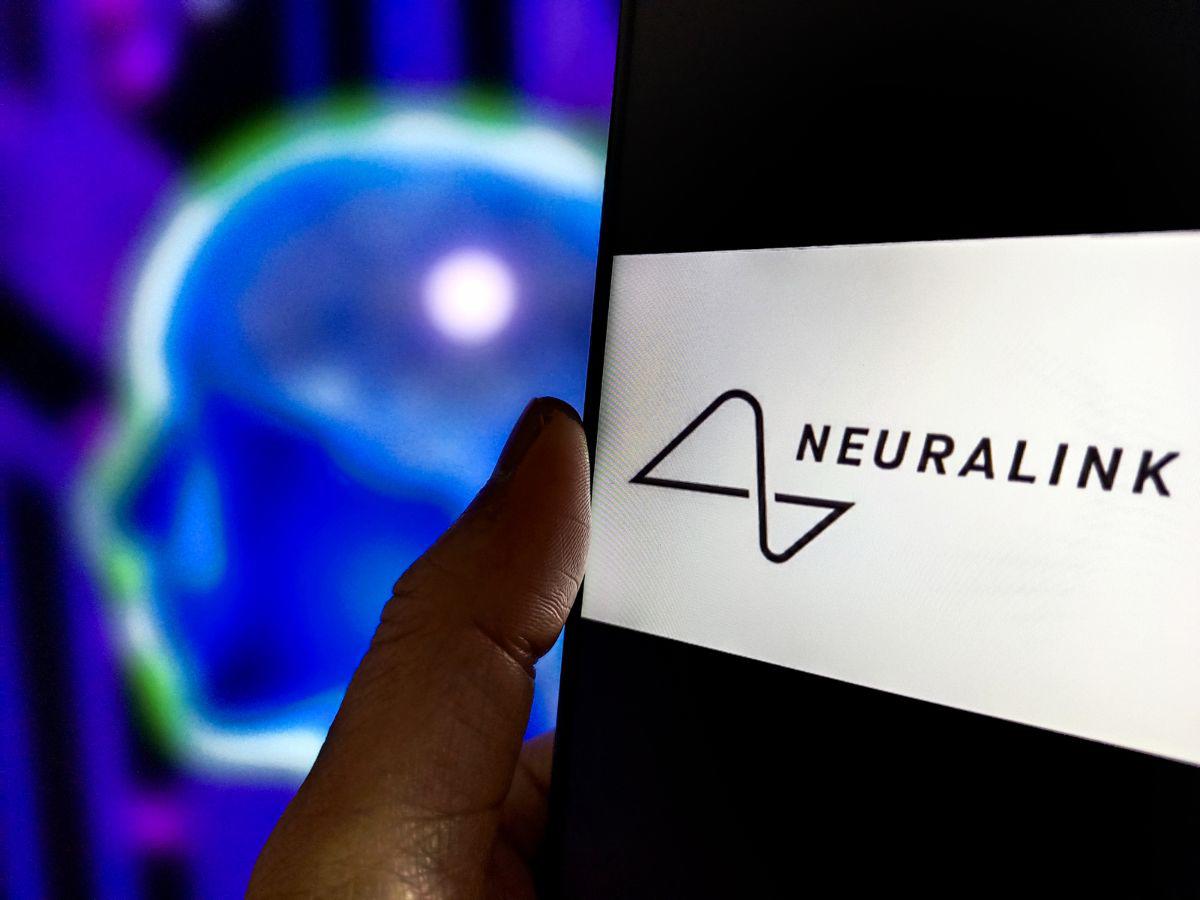 Neuralink: ¿para qué sirve el chip cerebral de Elon Musk?