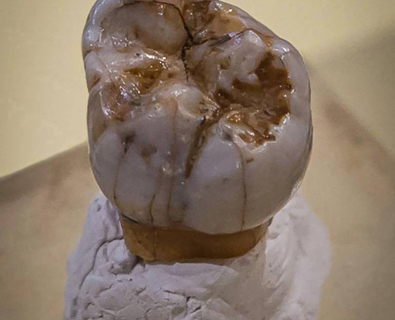 $!Un molar hallado en la cueva Denisova, en Siberia, en el 2000 es uno de los pocos fósiles identificados como denisovanos.