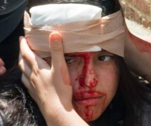 Una polémica manifestación de la extrema derecha estadounidense en Virginia se transformó en un drama luego de que un automóvil embistiera a una multitud de contra-manifestantes antirracistas, dejando un muerto. Fotos: AFP.