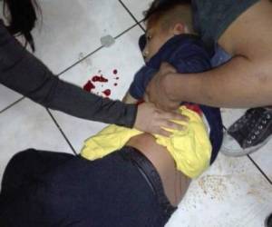 Uno de los menores que resultaron heridos la noche de este jueves en la colonia El Pedregal.
