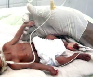 El pequeño nació prematuro hace cuatro días y lucha a diario para sobrevivir, se encuentra conectado a un respirador artificial.