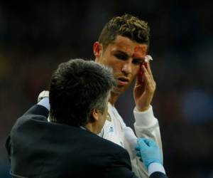Tras recibir el golpe, Cristiano Ronaldo salió de la cancha. Foto: AP