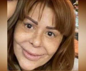 Esta foto de la famosa actriz y cantante mexicana Alejandra Guzmán revela el cambio que han provocado las cirugías estéticas en su rostro.