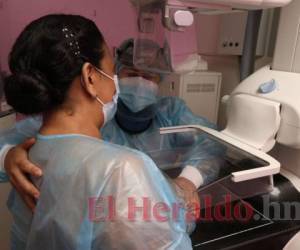 Funhocam ofrece mamografías gratis a pacientes de escasos recursos económicos. Foto: David Romero/El Heraldo