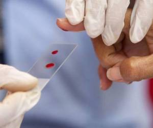 Estados Unidos levantó formalmente este lunes la prohibición de donar sangre de por vida vigente para homosexuales varones.