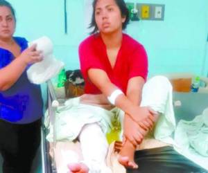 Mercy Navarro está muy afectada emocionalmente tras sufrir el accidente, urge de una operación de su pierna en el HEU.