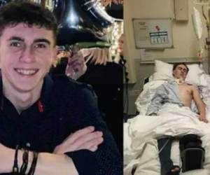 Joseph Flavill es un joven de 19 años estuvo en coma por 10 meses.