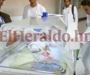 El bebé fue trasladado a la Sala de Cuidados Intensivos del Materno Infantil (Foto: Johny Magallanes)