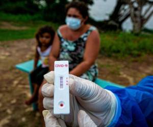 Los países que más fallecidos registraron el pasado lunes según los últimos balances oficiales fueron India con 871, México (705) y Brasil (703), los últimos dos pertenecientes a Latinoamérica. Foto: AP