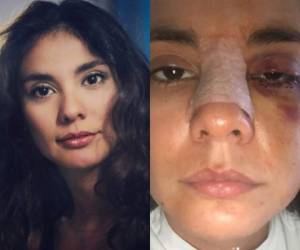 Eileen Moreno mostró cómo quedó su rostró tras la golpiza que le dio su exnovio. Fotos: Instagram