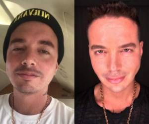 La apariencia de J Balvin provocó rumores de una posible operación en la cara. Foto Instagram @jbalvin