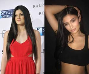 A los largo de sus 20 años, la guapa Kylie Jenner se ha hecho diversas transformaciones en su cuerpo. ¿Reconoces cuáles son sus cambios? Fotos: Shutterstock/Instagram