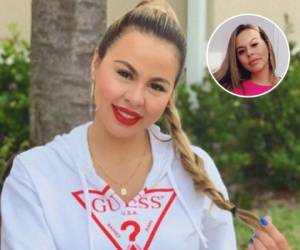 La youtuber y bloguera hondureña, Lipstickfables, decidió compartir con sus seguidores los cambios físicos que ha tenido su cuerpo tras haberse sometido a tres cirugías estéticas hace unas semanas. Fotos: Instagram