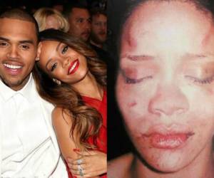 Chris Brown protagonizó uno de los mayores escandalos al golpear salvajemente a Rihanna en el rostro cuando eran pareja. La cantante de barbados luego lo perdonó, pero con el tiempo terminó su relación para siempre.