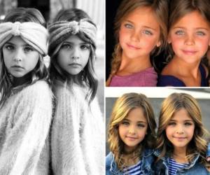 Leah Rose y Ava Marie son consideradas las gemelas más bellas del mundo.