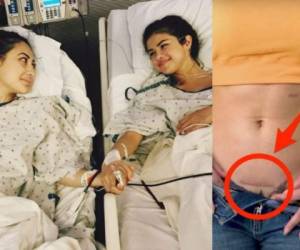 La actriz muestra la cicatriz que le ocasionó el trasplante renal. Foto Instagram/Captura YouTube