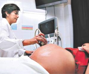 Las mujeres embarazadas deben someterse estrictamente a los controles prenatales mensualmente.