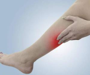 Esta enfermedad se produce cuando se forman coágulos de sangre en las venas profunfas, normalmente de las piernas. Cortesía Vix.com