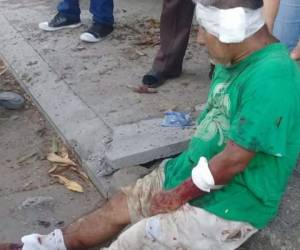 La persona lesionada responde al nombre de Ángel Orellana, de 64 años. (Foto: Twitter)