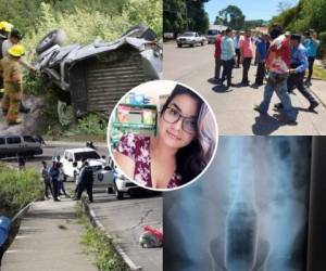 Un accidente mortal en la cuesta de La Moramulca, una masacre en La Ceiba, el cadáver encostalado de una mujer en la cuesta de El Chile, un paciente con una botella en el ano y el hallazgo del cuerpo de una joven que había desaparecido figuran en los sucesos de Honduras de la semana del 31 de julio al 4 de agosto. Foto: Cortesía.