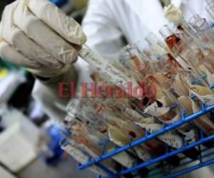 El coordinador nacional de Vigilancia de la Salud, doctor Homer Mejía, aseguró que están a la espera de los resultados de laboratorio para conocer si en efecto esta muerte fue por influenza. (Foto: El Heraldo Honduras)