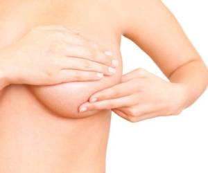 Entre los síntomas que debes tener en cuenta, está la inflamación de la mama, además de irritación cutánea o formación de hoyos. Foto:www.crhoy.com