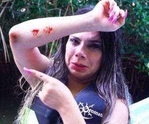 Lizbeth Rodríguez compartió esta imagen en su cuenta de Instagram donde muestra sus heridas tras el accidente.