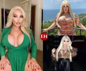 Jessica Alves, mejor conocida como 'La barbie humana', es una mujer transexual que se ha sometido a más de 150 cirugías para mejorar su aspecto y parecer cada vez más femenina, sin embargo, esta vez cruzó barreras al anunciar su próxima e insólita operación: un trasplante de útero.La brasileña busca dar a luz a sus propios hijos, lo que la convertiría en la primera trans en lograrlo. Según transcendió, la joven ya tiene fecha de operación, misma que ronda los 42 mil dólares.En esta galería te contaremos más sobre la polémica vida de Jessica Alves, quien ha sorprendido al mundo entero con sus polémicas decisiones. Foto: Instagram jessicaalvesuk