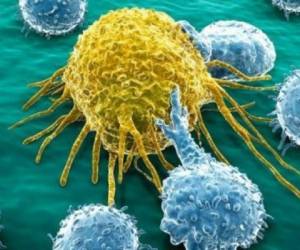 Esta es una imagen de la célula cancerigéna en el cuerpo. Foto Vix.com
