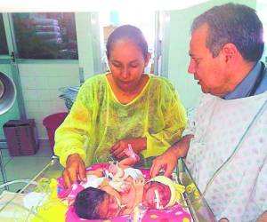 Jaqueline Quiroz durante la primera visita a sus niñas siamesas.