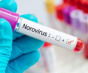 El norovirus es muy infeccioso y causa vómitos y diarrea, pero generalmente desaparece en un par de días, indica la autoridad británica. Foto: AFP