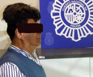 Los policías notaron que la cabeza del sospechoso lucía anormal. Debajo del peluquín llevaba un paquete de droga. Foto: Cortesía Policía de España.