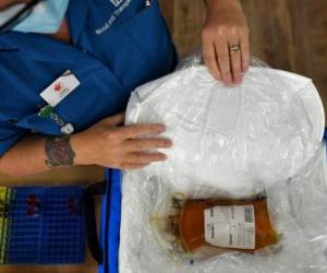 Según los resultados, 'el estudio dice que en todos los pacientes la incidencia de la enfermedad grave bajó a la mitad'. Foto: AFP