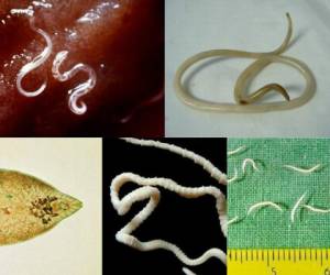 Estos parasitos viven el cuerpo del ser humano, normalmente en el intestino.